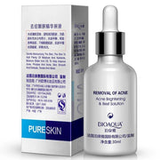 Bioaqua Acne Removal Serum